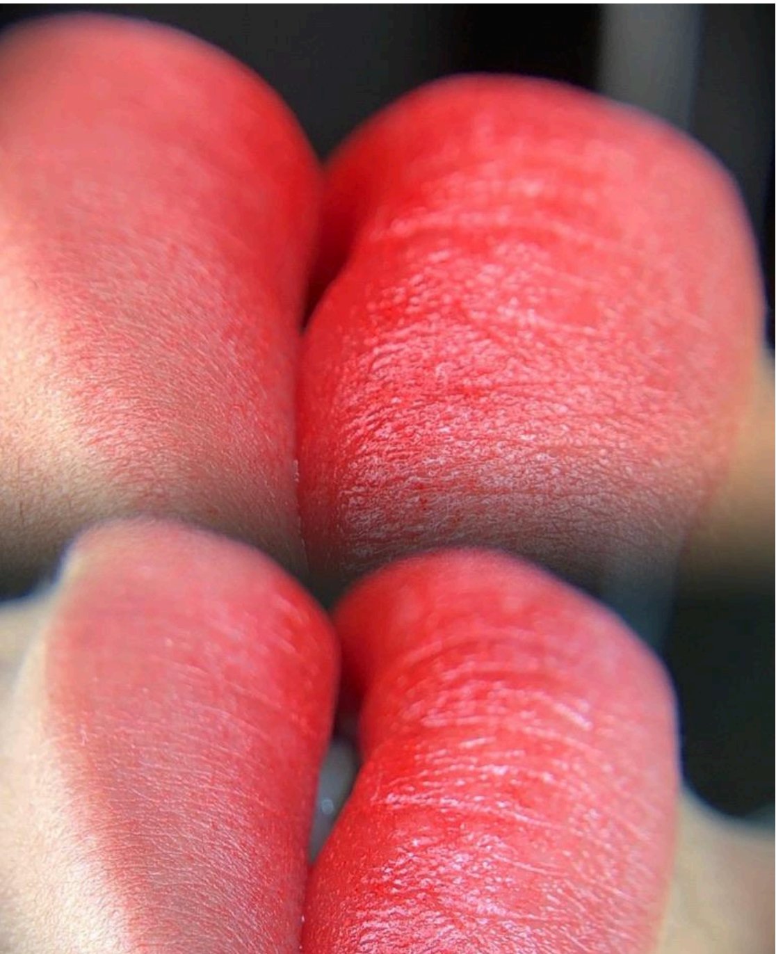 Resultado de micropigmentación de labios - Bombombum Lips