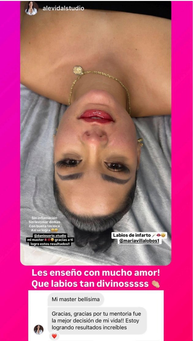Story de Ale Vidal - Resultados de Bombombum Lips